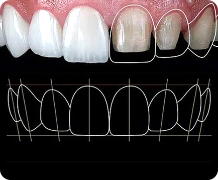 Công nghệ thiết kế nụ cười Dịch vụ: Công nghệ thiết kế nụ cười