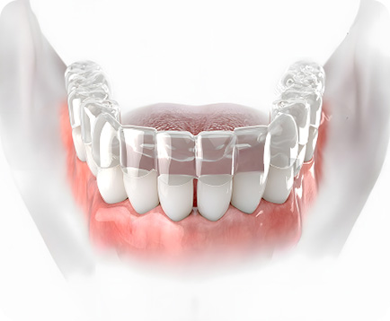 Niềng răng trong suốt Dịch vụ: Niềng răng trong suốt