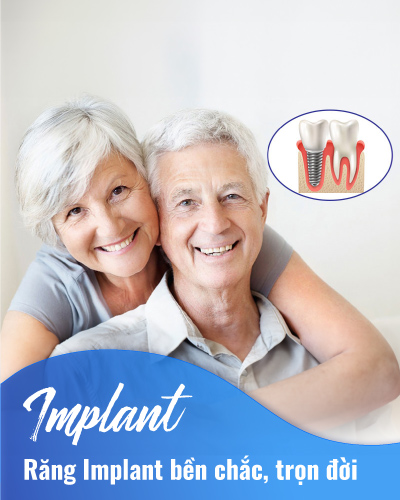 Răng Implant bền chắc, trọn đời