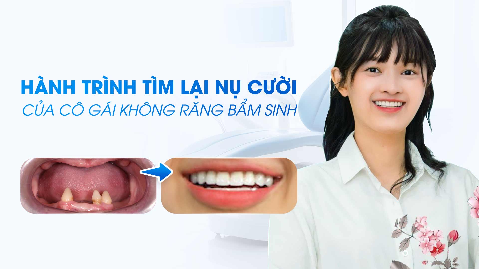 Hình: Bác sĩ Việt Nam thực hiện thành công 3 kỹ thuật cấy ghép Implant phức tạp