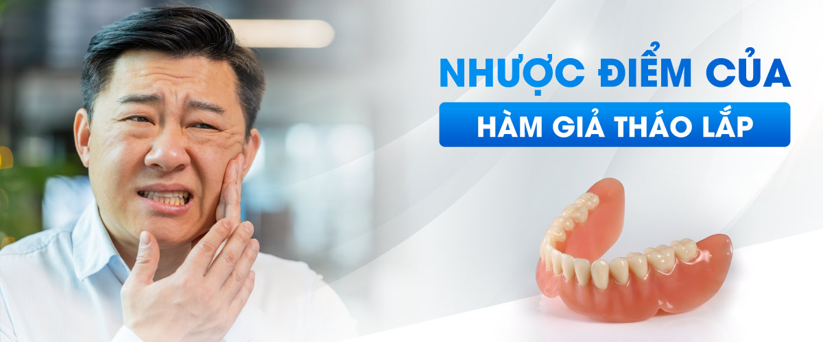 hàm giả tháo lắp Hình: hàm giả tháo lắp