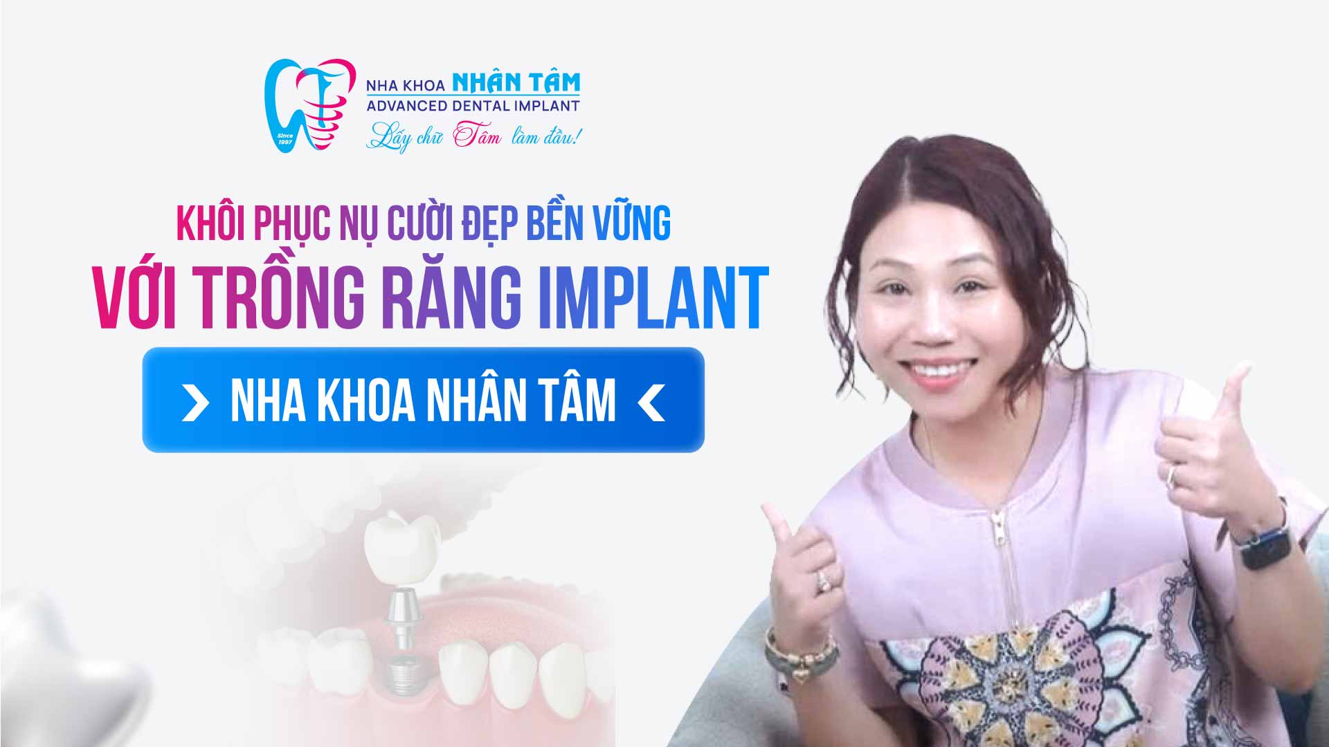Hình: Khôi phục nụ cười đẹp bền vững với trồng răng Implant