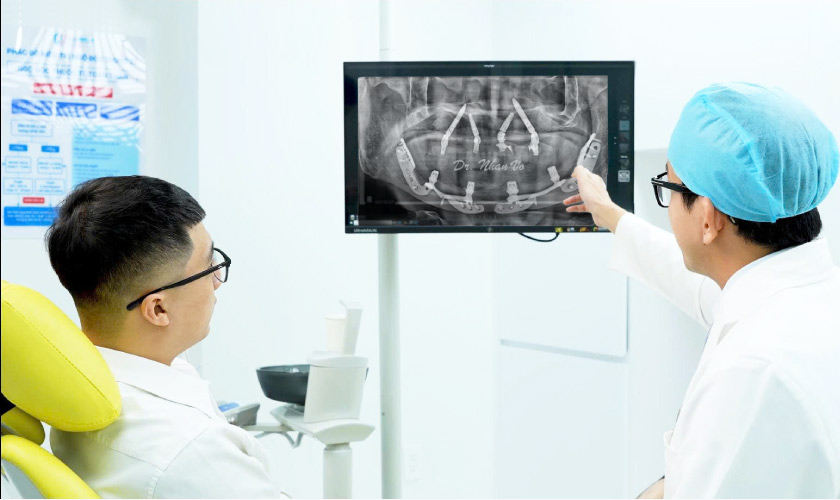 Hình: Kem đánh răng than hoạt tính