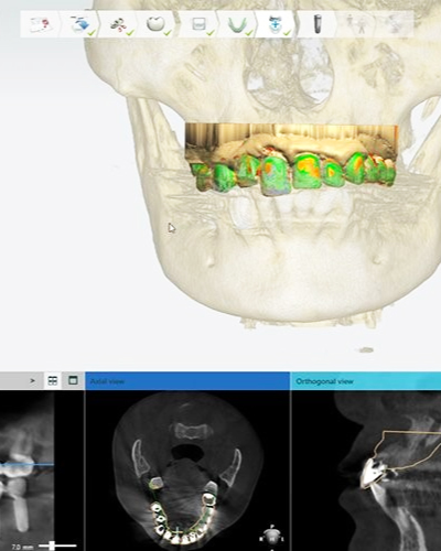 Bước 2 Hình: Bước 2