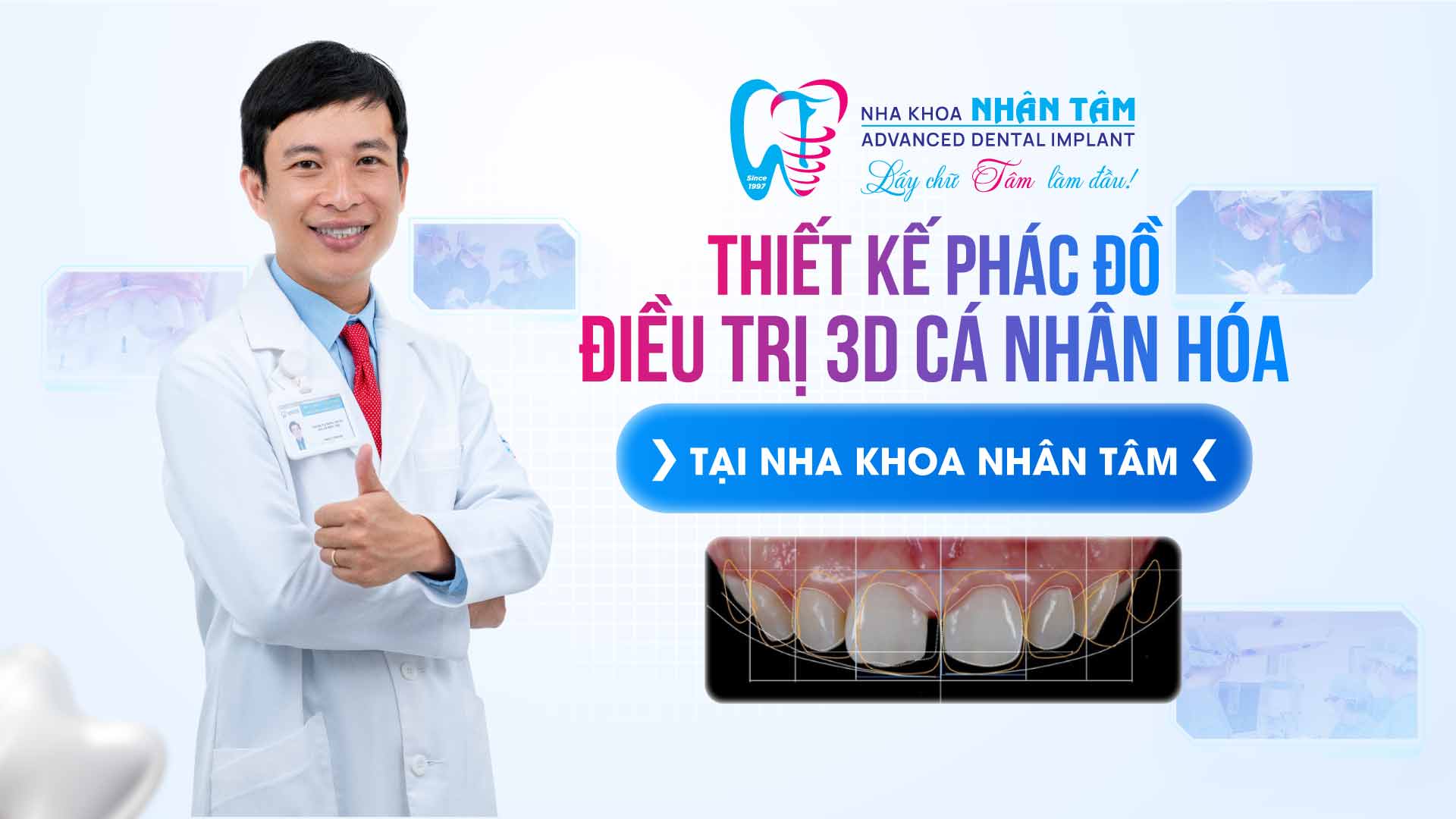 Hình: Thiết kế phác đồ điều trị 3D cá nhân hóa