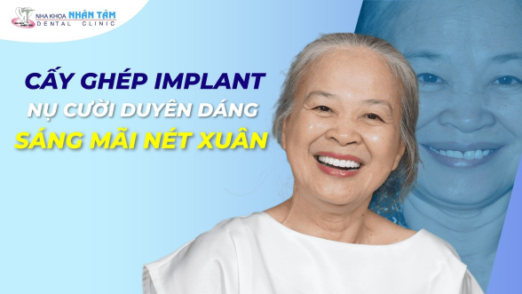 Cấy ghép implant - Nụ cười duyên dáng - Sáng mãi nét xuân