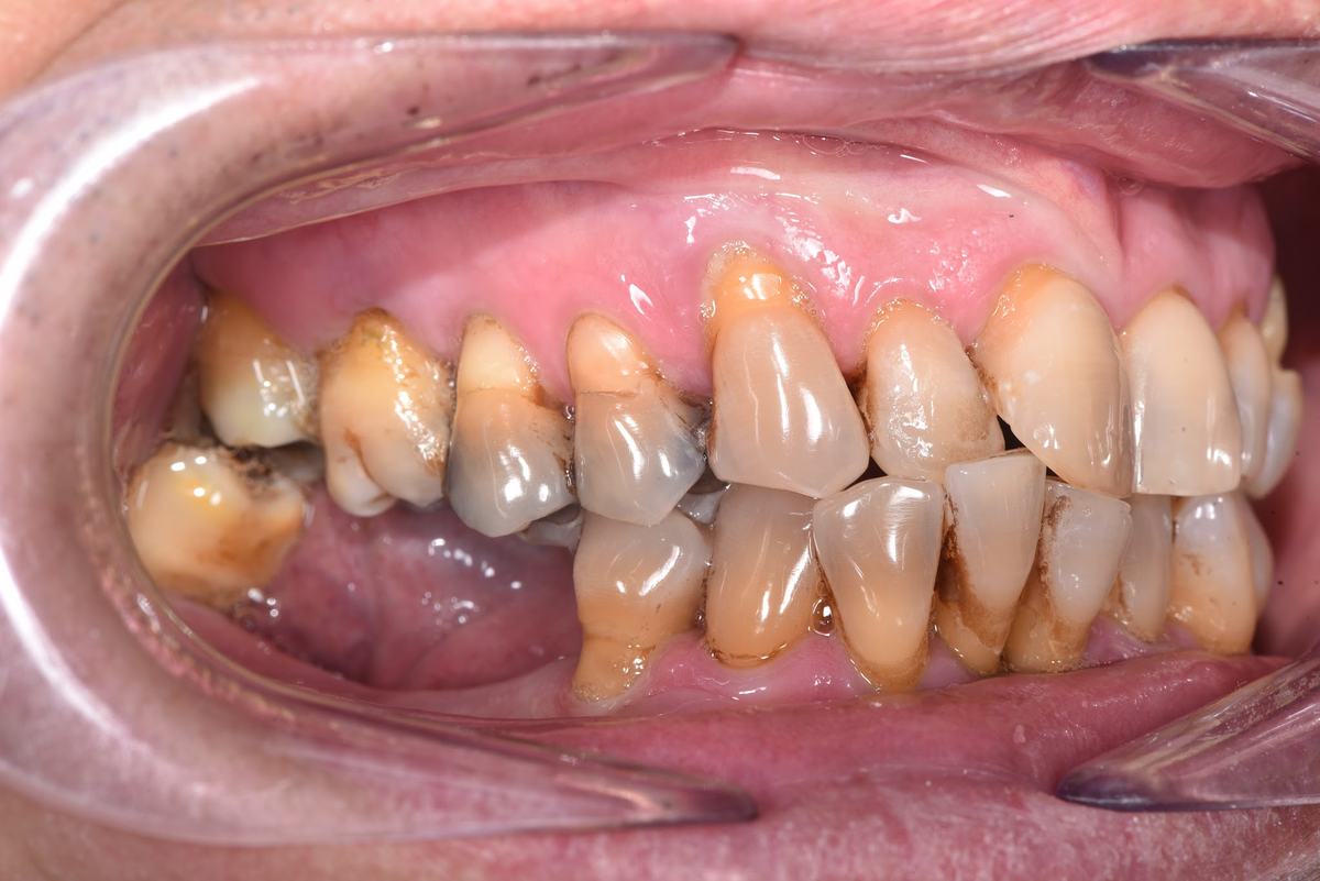 Hình: Anh Đoàn Hưng Cường (Việt kiều Mỹ) – tình trạng trước điều trị