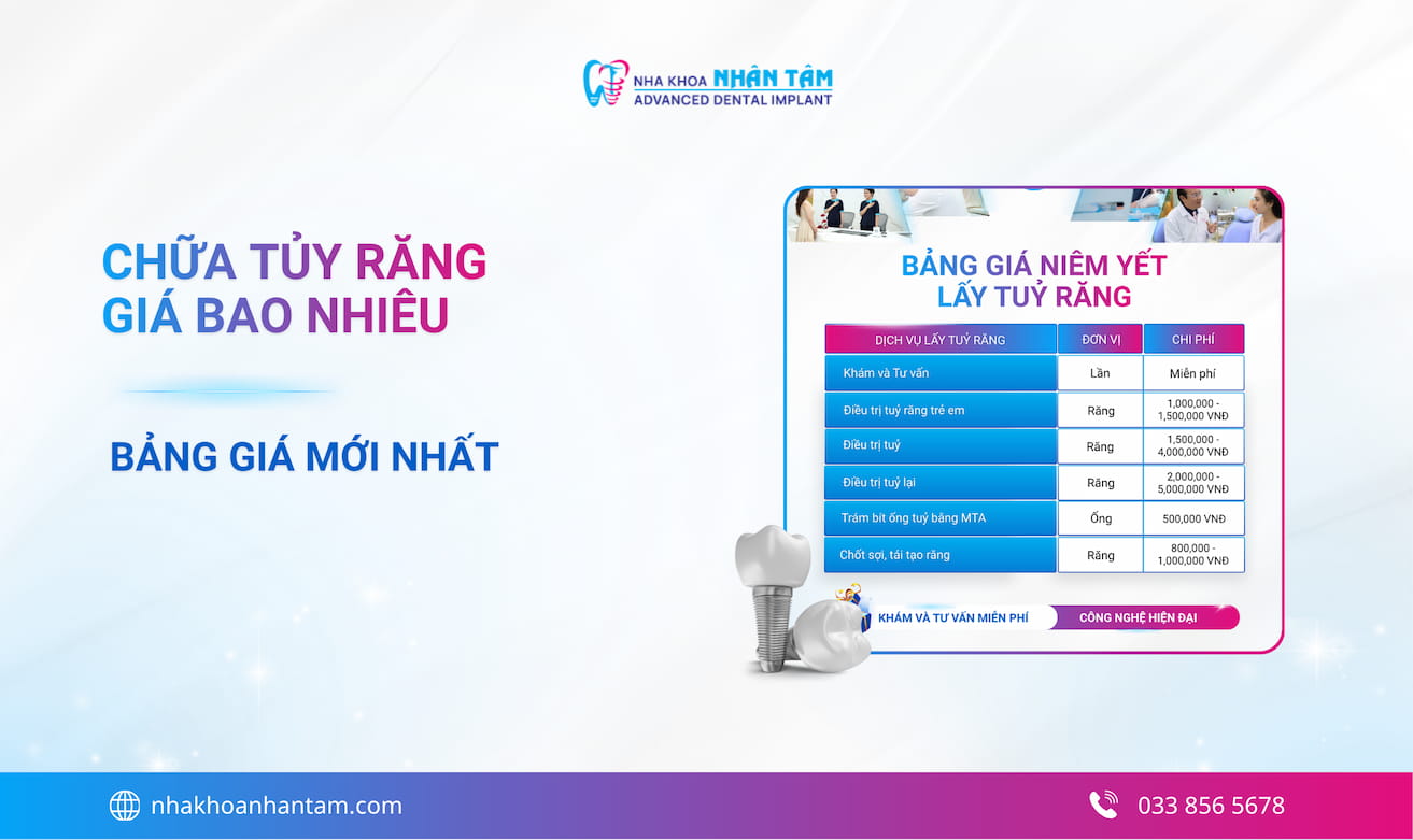 Hình: Chữa tủy răng giá bao nhiêu? Bảng giá mới nhất 2026