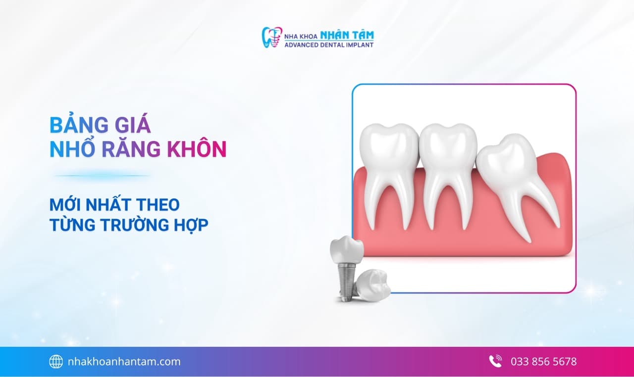 Nhổ răng khôn giá bao nhiêu? Bảng giá nhổ răng khôn mới nhất 2026