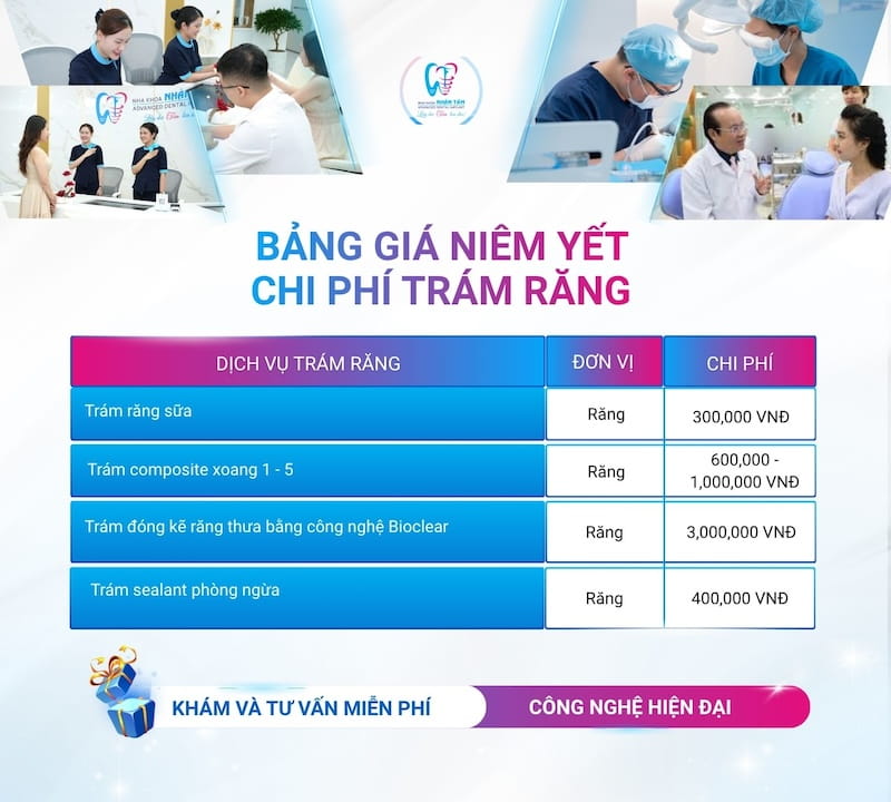 bảng giá trám răng thẩm mỹ