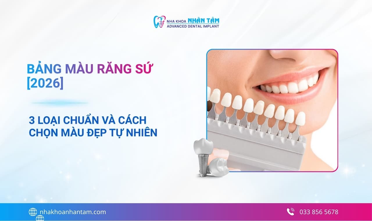 Bảng màu răng sứ [2026]: 3 Loại chuẩn và cách chọn màu đẹp tự nhiên