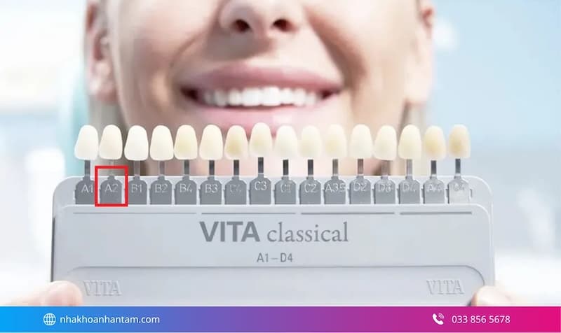 các màu răng sứ phổ biến