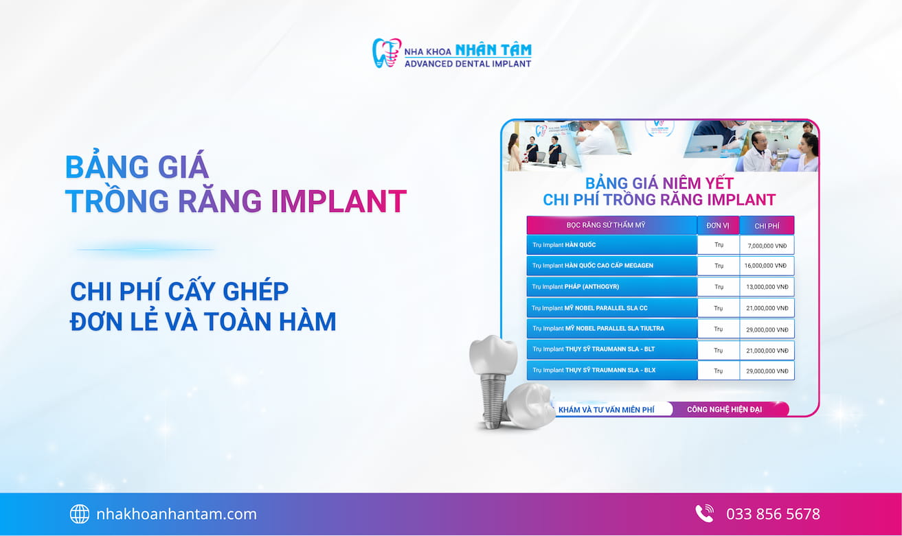 Hình: Bảng giá trồng răng Implant mới nhất Tháng 5/2026