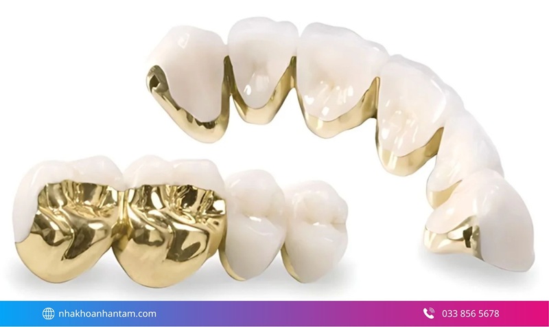 bọc răng sứ có an toàn không