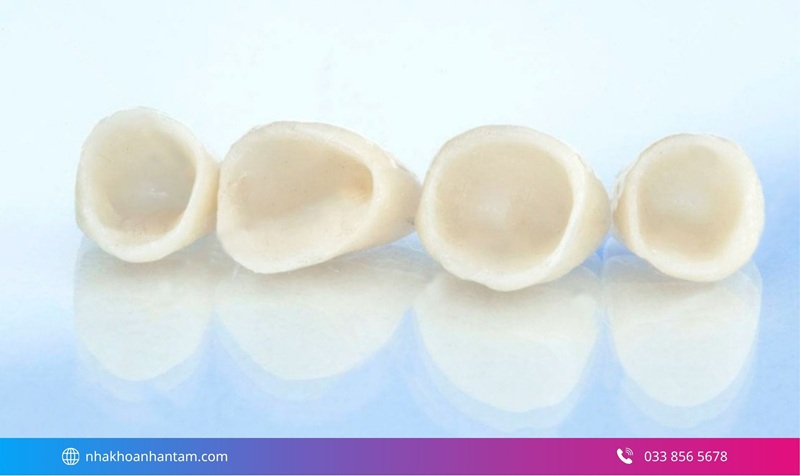 bọc răng sứ có ảnh hưởng gì không