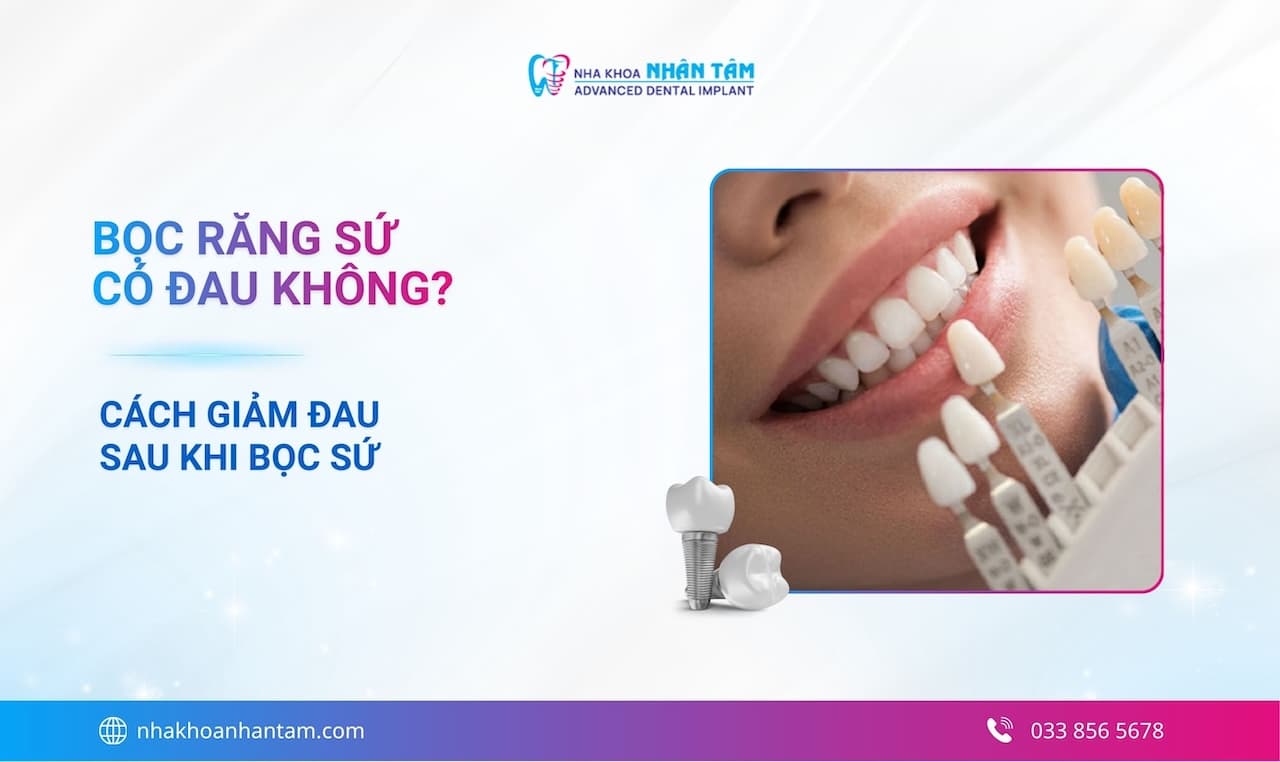 Hình: Bọc răng sứ có đau không? Cách giảm đau sau khi bọc sứ 