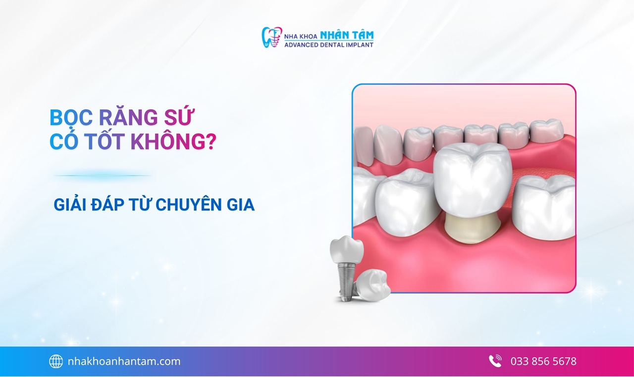 Giải đáp: Bọc răng sứ có tốt không?