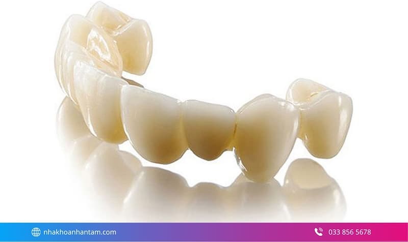 bọc răng sứ giá bao nhiêu