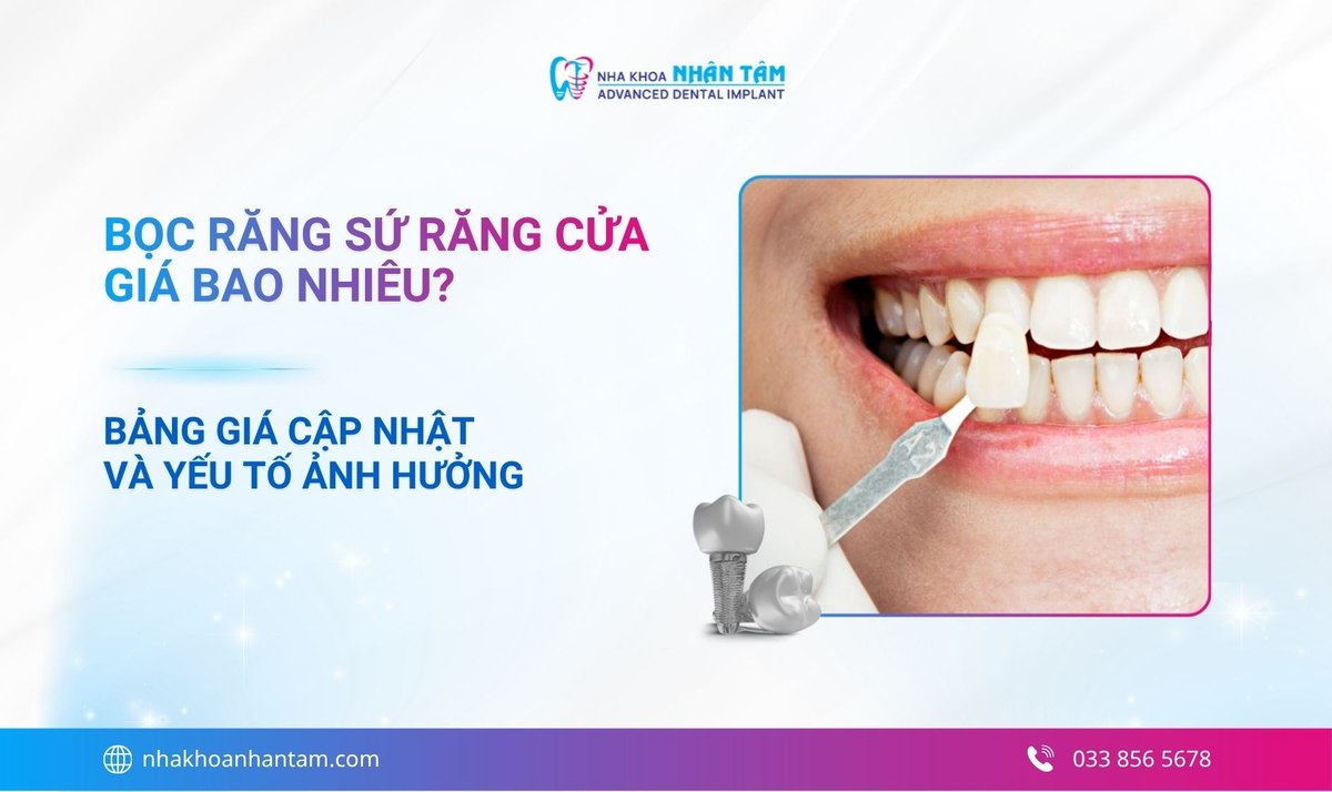 Bọc răng sứ răng cửa giá bao nhiêu? Bảng giá cập nhật và yếu tố ảnh hưởng
