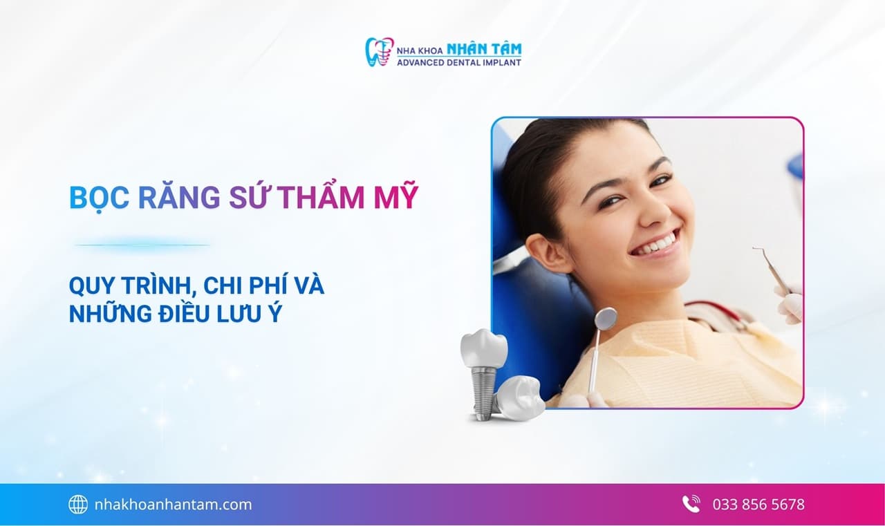 Hình: Bọc răng sứ thẩm mỹ là gì? Quy trình, chi phí và những điều lưu ý