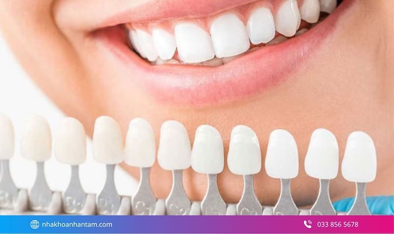 bọc răng sứ trả góp thẻ tín dụng