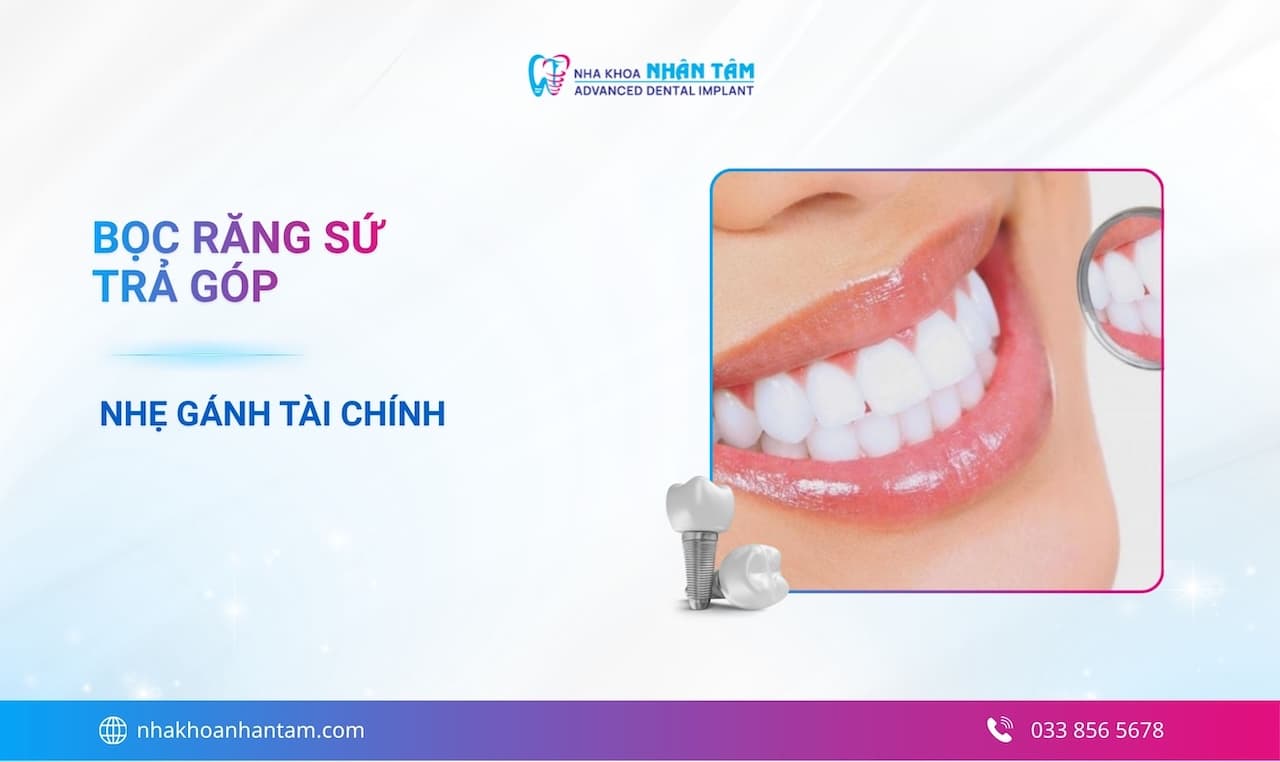 Hình: Bọc răng sứ trả góp, lãi suất 0% - Giải pháp phục hình thẩm mỹ nhẹ gánh tài chính