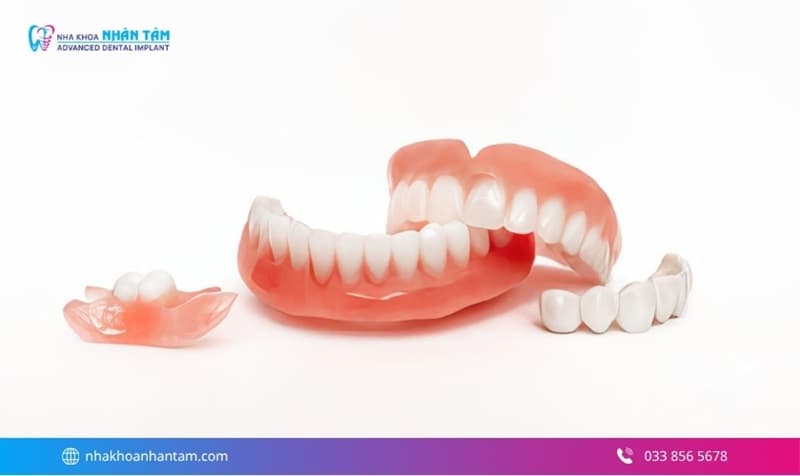 các phương pháp làm răng thay thế