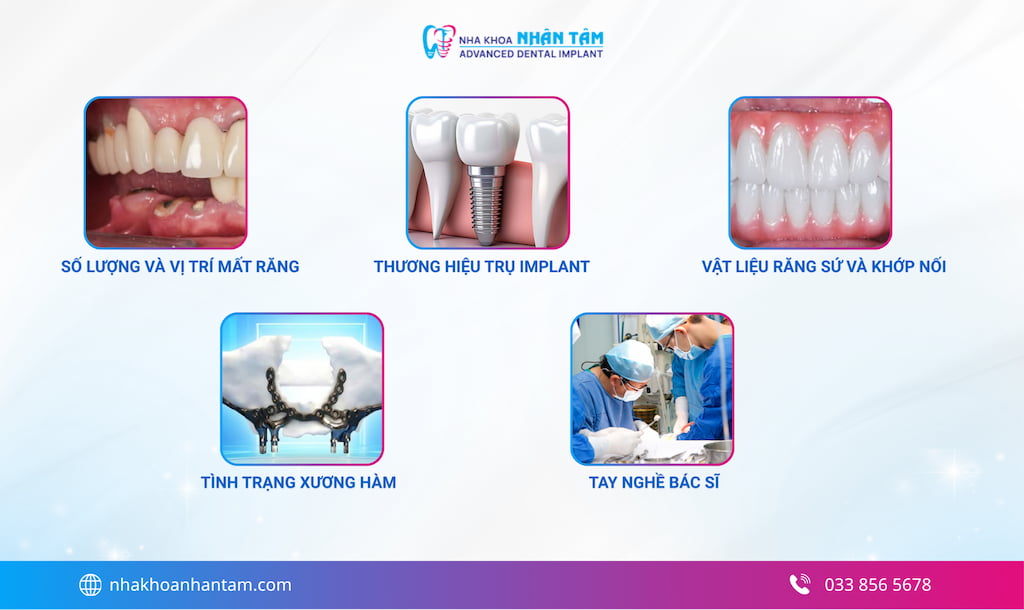Các yếu tố ảnh hưởng đến chi phí trồng răng Implant Hình: Các yếu tố ảnh hưởng đến chi phí trồng răng Implant