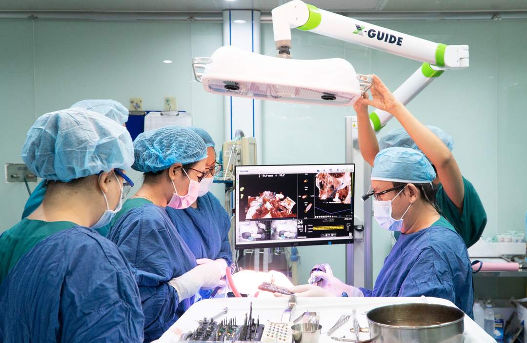 Hình: Bác sĩ tiến hành cắm trụ Implant vào xương hàm theo kế hoạch