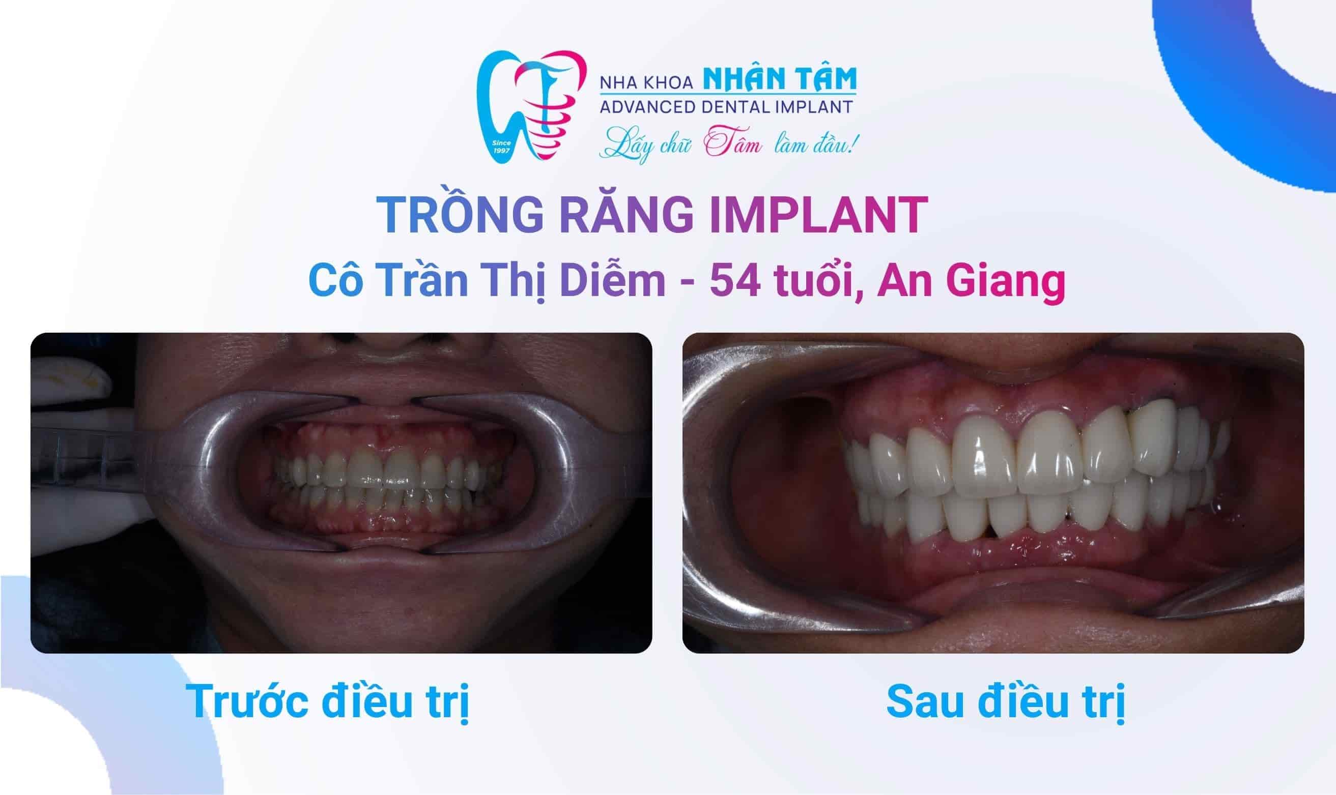 Tự tin mỗi ngày với nụ cười tươi trẻ tại Nhân Tâm