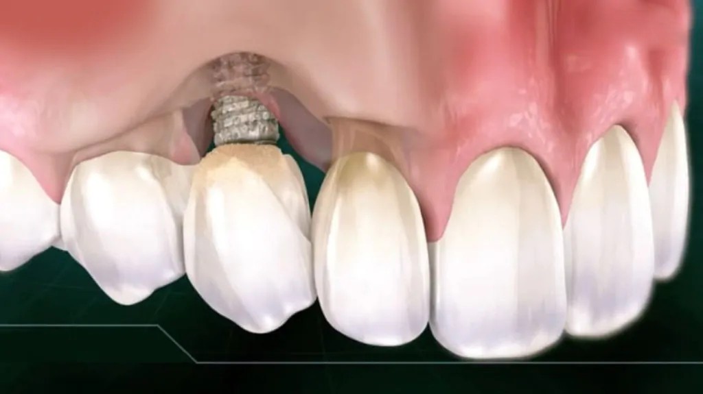 Hình: Thăm khám và chụp phim kiểm tra giúp xác định chính xác mức độ viêm nhiễm cũng như tình trạng tiêu xương