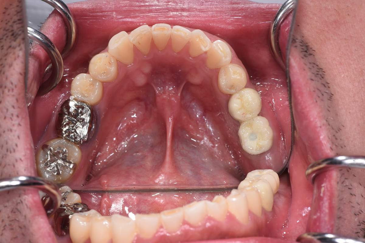 Hình: Chị Đào Phương Nghi – tình trạng trước điều trị