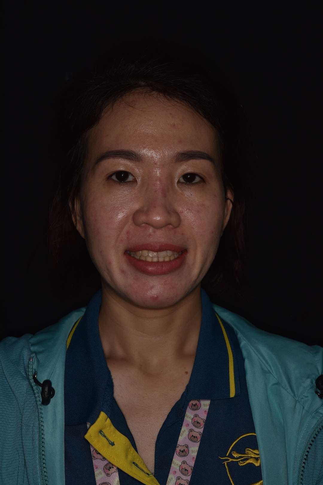 Chị Kiều Linh – kết quả sau điều trị Hình: Chị Kiều Linh – kết quả sau điều trị