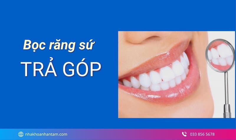 chi phí răng sứ trả góp