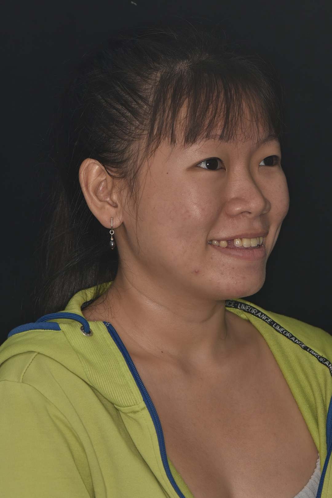Hình: Chị Thanh Vy (Việt kiều Singapore) – tình trạng trước điều trị