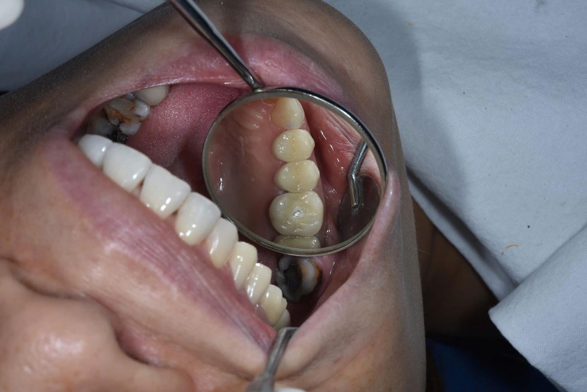 Chị Trương Xuân Hạnh – quá trình điều trị Hình: Chị Trương Xuân Hạnh – quá trình điều trị