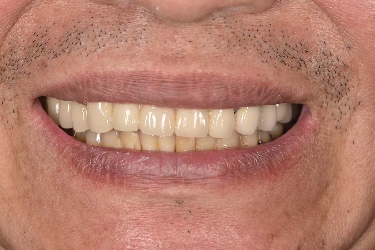 Hình: Chú Huỳnh Thanh Tuấn (Việt kiều Úc) – quá trình điều trị