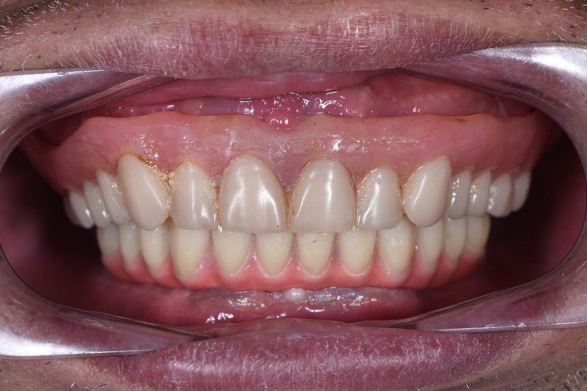 Hình: Chú Lê Văn Trinh – quá trình điều trị