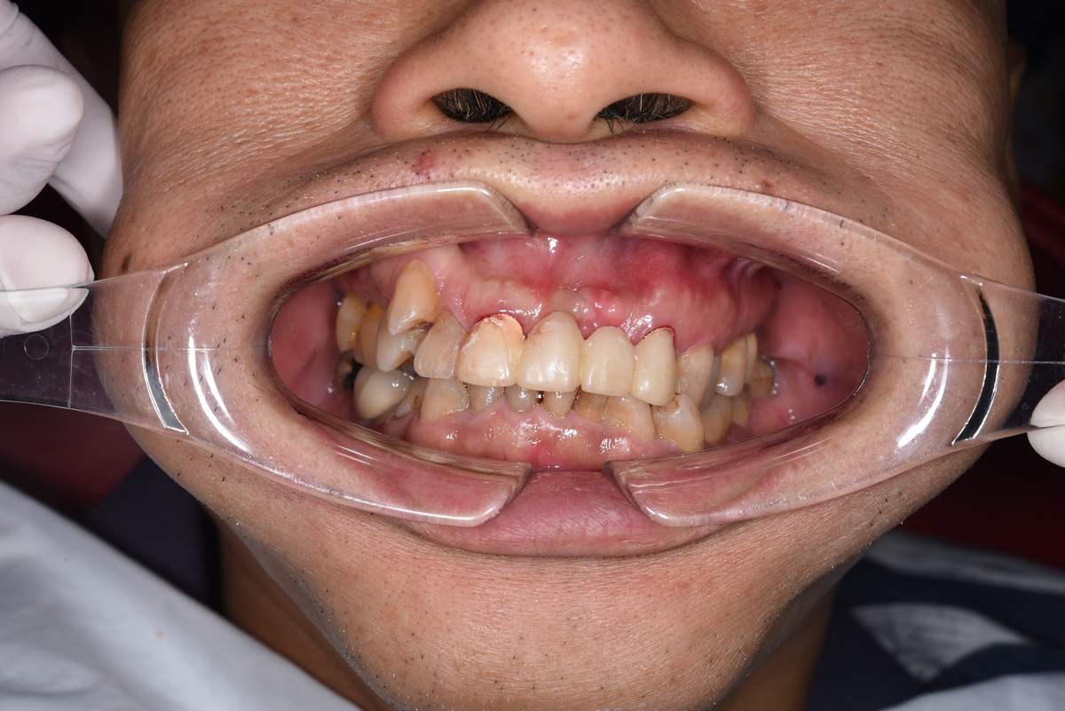 Chú Nguyễn Minh Huy – tại Nha khoa Nhân Tâm Hình: Chú Nguyễn Minh Huy – tại Nha khoa Nhân Tâm
