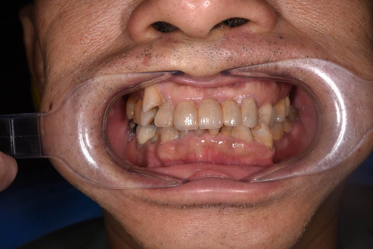 Chú Nguyễn Minh Huy – tại Nha khoa Nhân Tâm Hình: Chú Nguyễn Minh Huy – tại Nha khoa Nhân Tâm