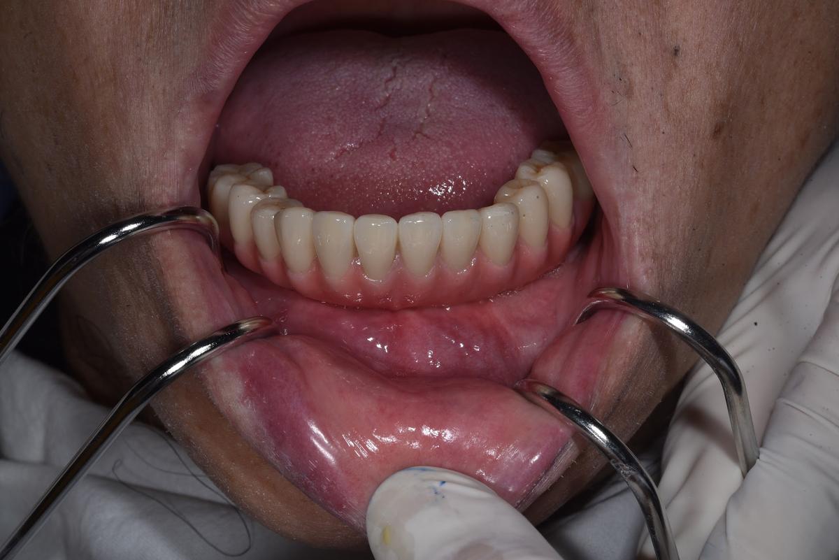 Hình: Chú Phạm Đức Nguồn – tại Nha khoa Nhân Tâm