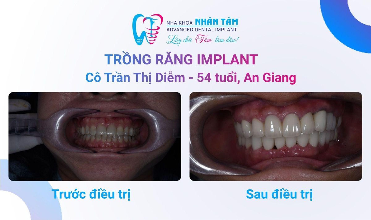 Hình: Chú Võ Trí Thiện và Cô Trần Thị Diễm – tại Nha khoa Nhân Tâm