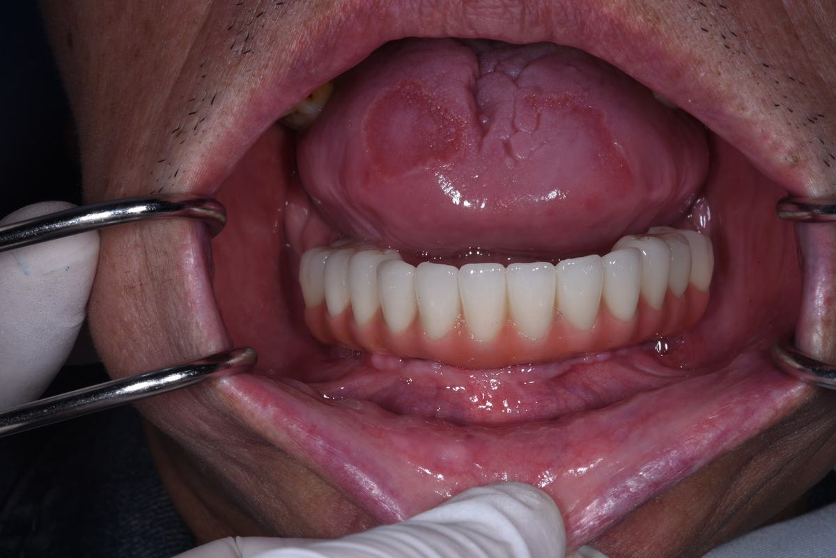 Hình: Chú Võ Trí Thiện và Cô Trần Thị Diễm – quá trình điều trị