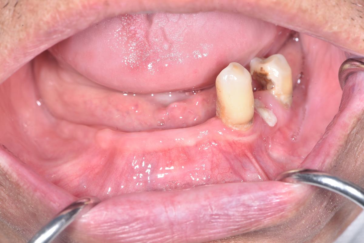 Hình: Chú Võ Trí Thiện và Cô Trần Thị Diễm – tình trạng trước điều trị