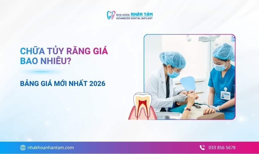 Chữa tủy răng giá bao nhiêu? Bảng giá mới nhất 2026