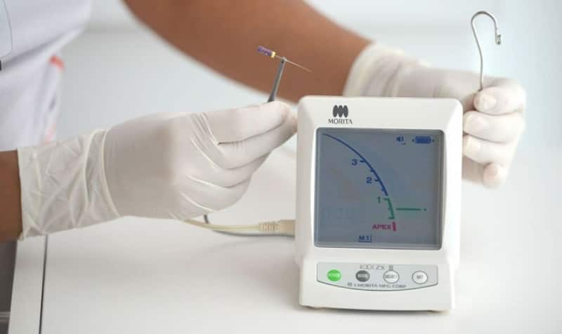 chữa tủy răng ở tphcm