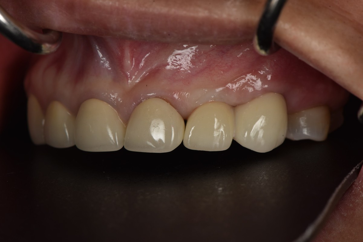 Hình: Cô Huỳnh Bông Lai – quá trình điều trị