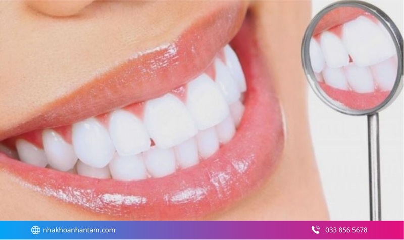 có nên bọc răng sứ không
