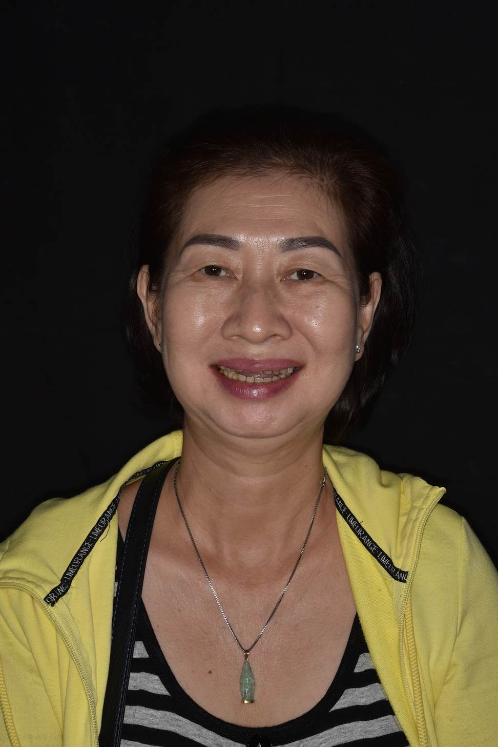 Hình: Cô Nguyễn Thị Kim Liên – kết quả sau điều trị