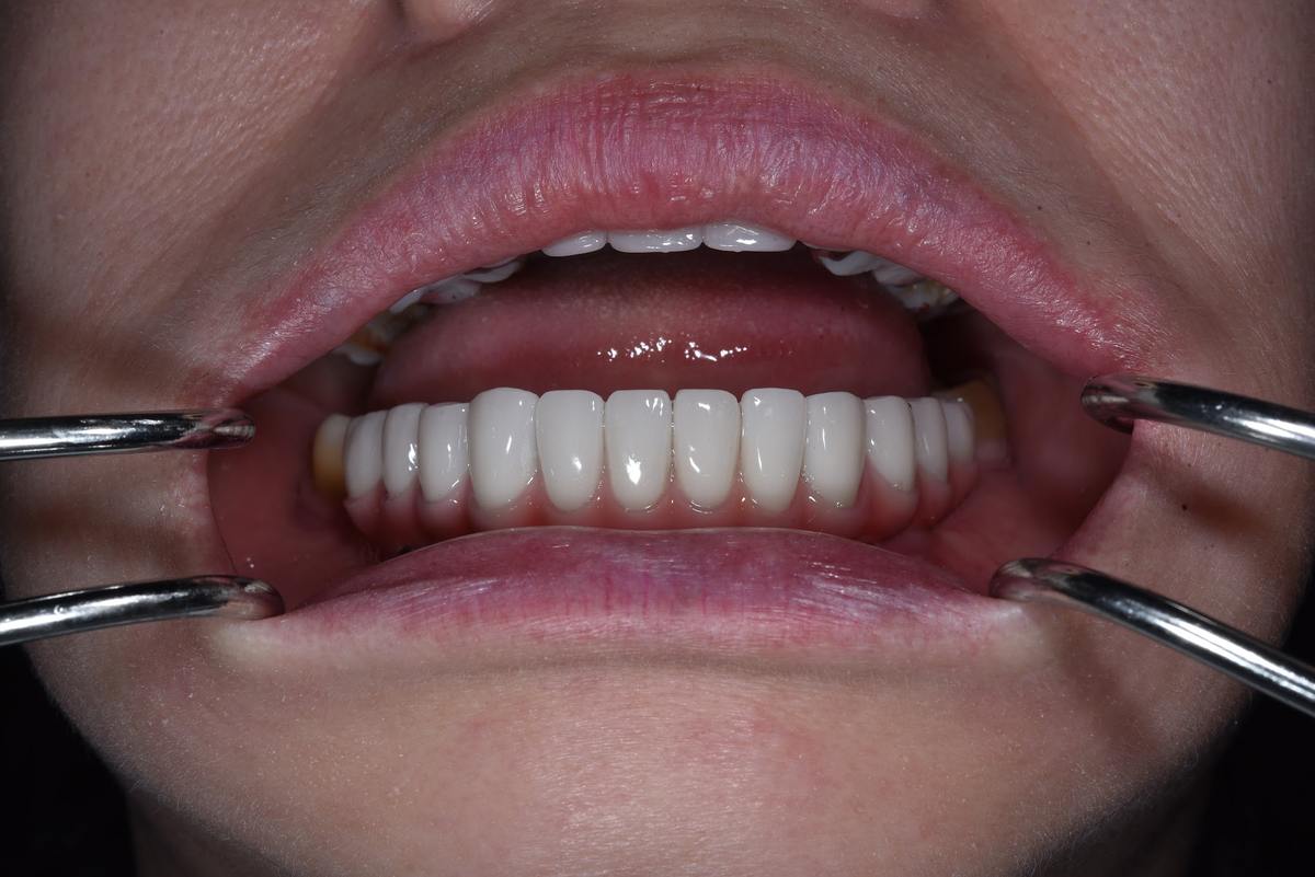 Hình: Cô Nguyễn Thị Kim Liên – quá trình điều trị